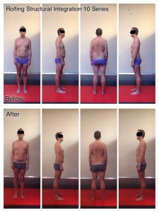 Paul T before and after