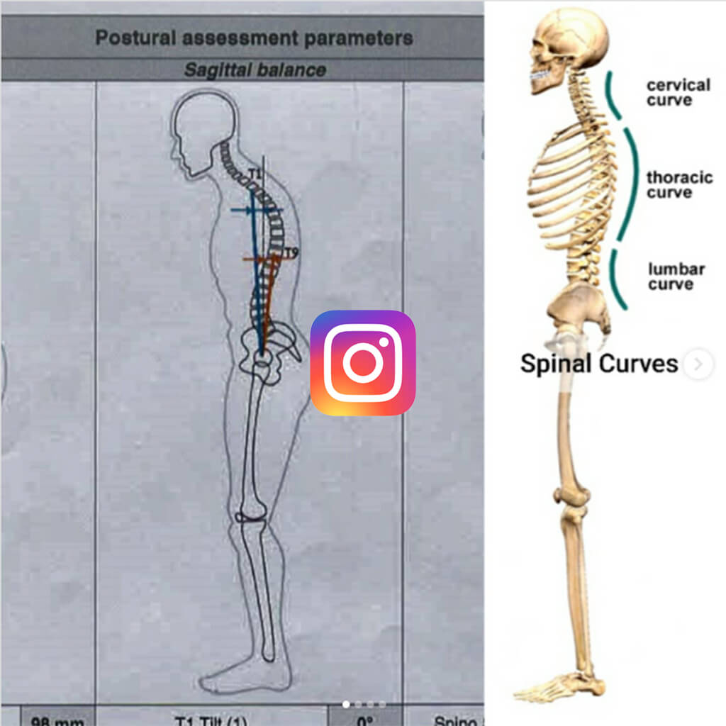 I've helped clients with shoulder, back, neck, and knee issues, improving through better movement despite varying factors like musculoskeletal problems or structural damage.