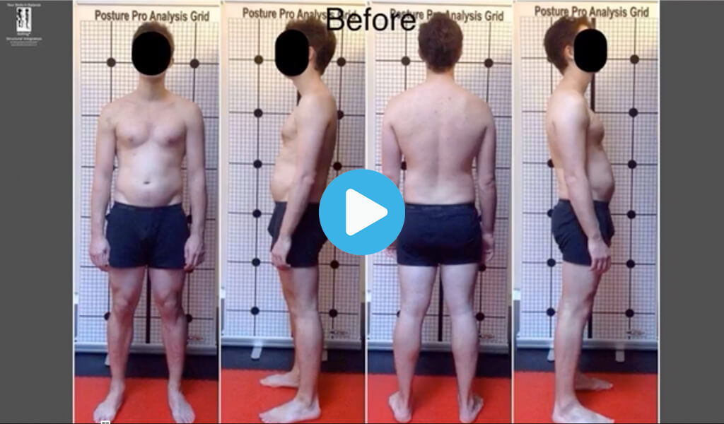 The Rolfing Ten Series: Each hour-long session focuses on different body areas, creating a comprehensive framework for long-term healthy movement and posture maintenance.